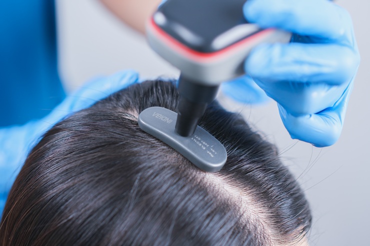 Testé et approuvé : la trichologie, la tendance cheveux et cuir chevelu dont tout le monde parle – chez Svenson
